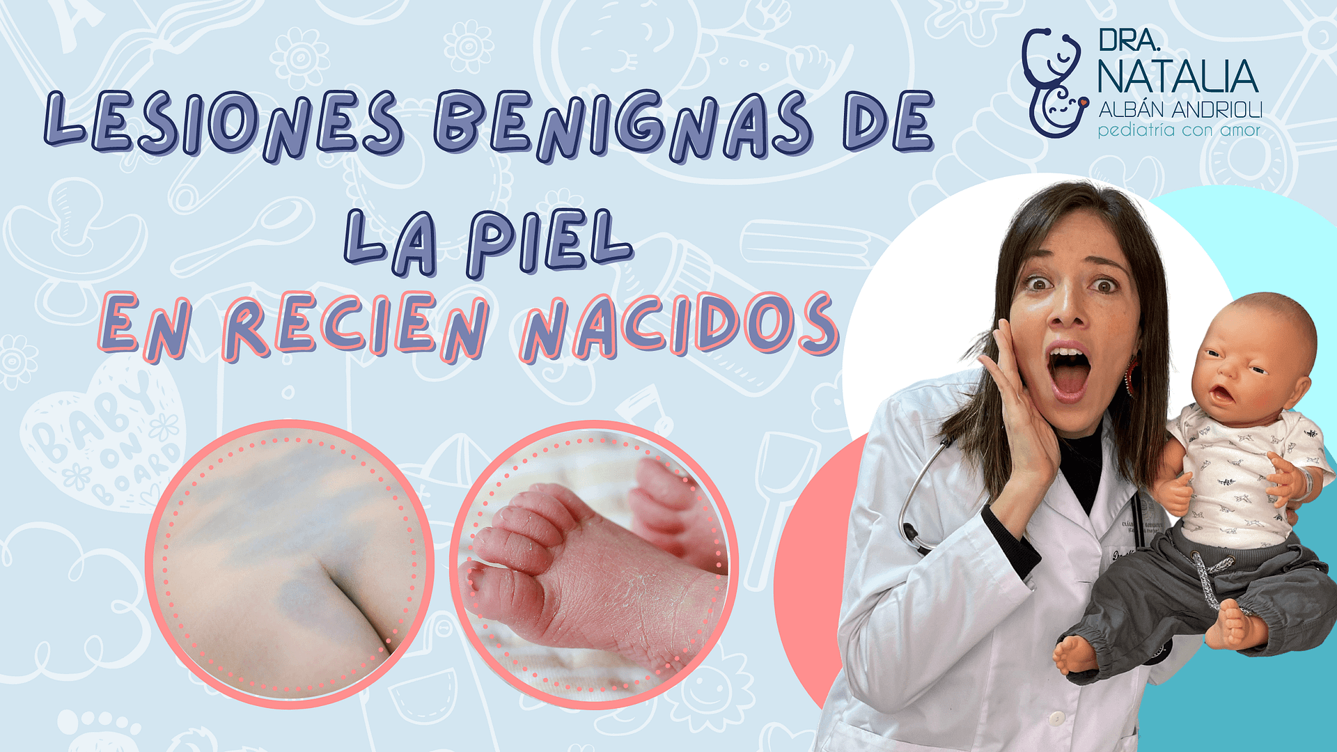 Lesiones benignas de la piel en recién nacidos - Dra. Natalia Albán